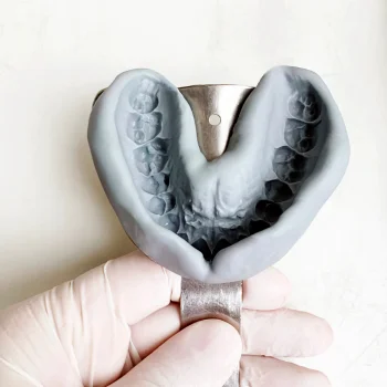 dental impression of teeth held by a latex gloved hand