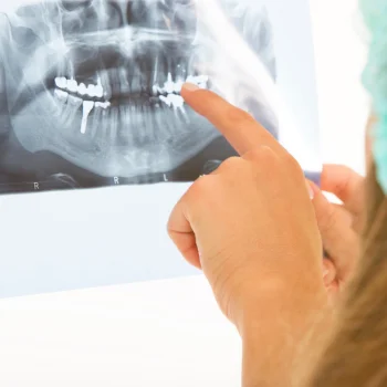 dental assistant pointing at a tooth on an xray
