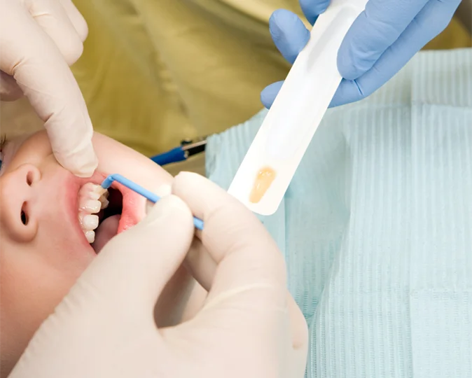 dentist and assistant applying fluoride to a young boys mouth